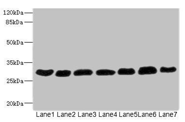 PGAM2 Antibody (PACO45506)