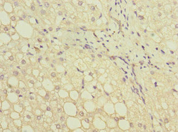 GATC Antibody (PACO45544)