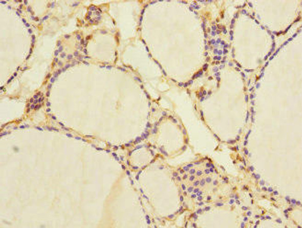 NFKBIE Antibody (PACO45550)