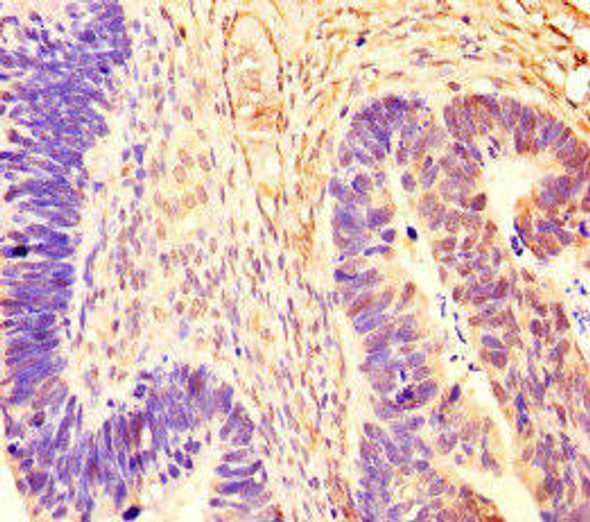 RCOR1 Antibody (PACO46162)