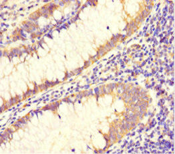 DAAM2 Antibody (PACO46734)
