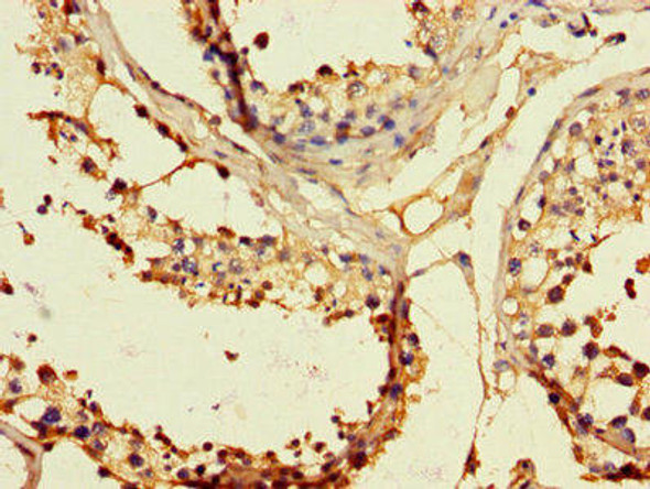 EPHB2 Antibody (PACO47398)