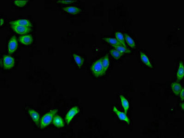 SCGB1A1 Antibody (PACO47630)