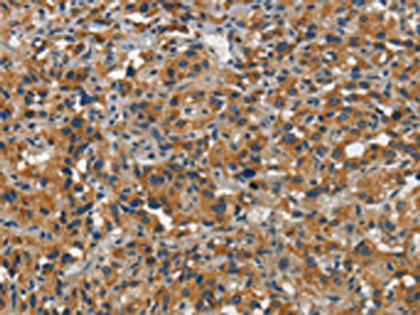 CEACAM1 Antibody (PACO18692)