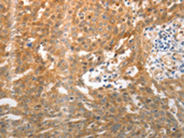 NQO1 Antibody (PACO18779)