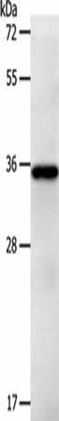 LPPR5 Antibody (PACO18810)