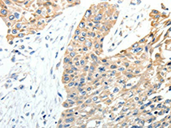 STEAP4 Antibody (PACO18937)