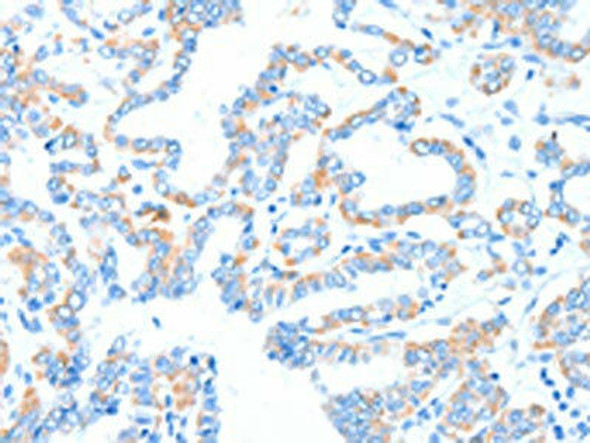 GPT Antibody (PACO19080)