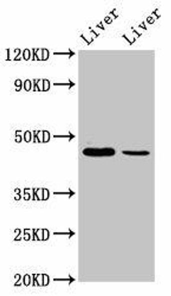 DDB2 Antibody (PACO56062)