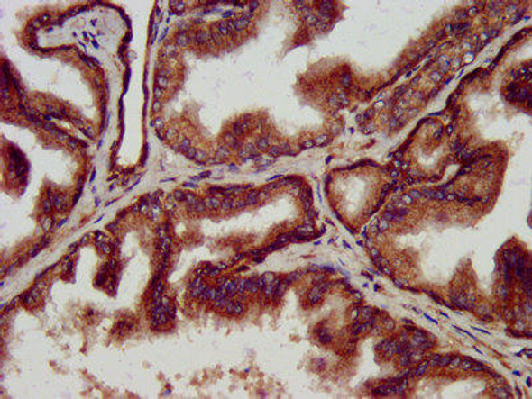 CLPP Antibody (PACO57116)