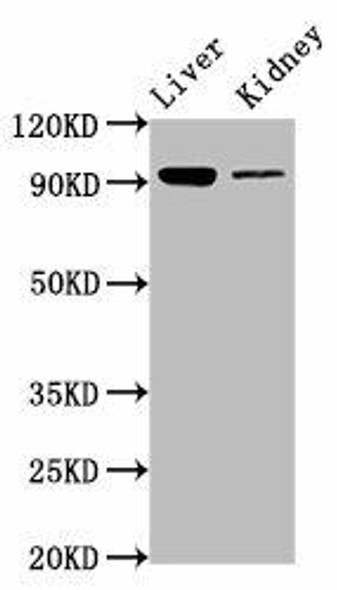 DMGDH Antibody (PACO57532)