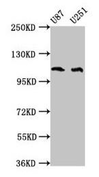 ABL2 Antibody (PACO57648)