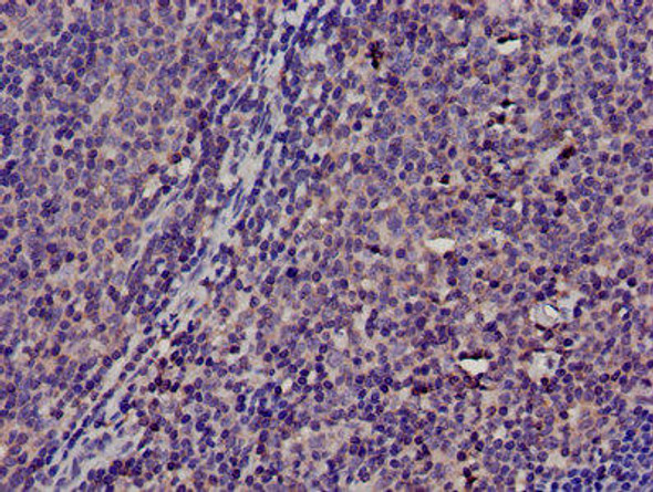 TMSB4X Antibody (PACO58004)