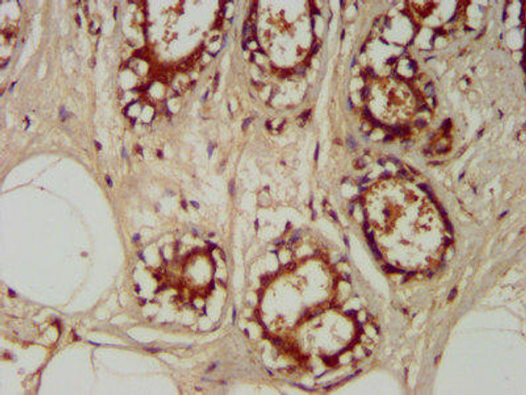 TRAPPC6A Antibody (PACO58008)