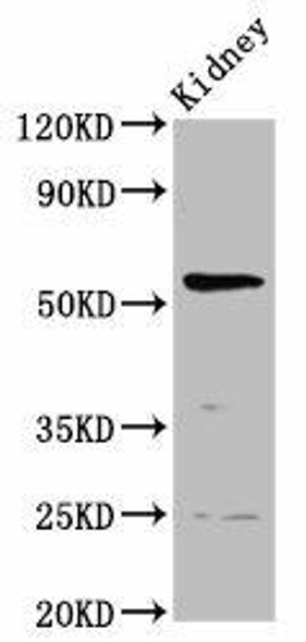 PIGW Antibody (PACO58240)