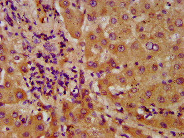 NUDT5 Antibody (PACO58596)