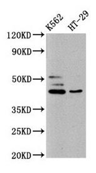 B3GNT6 Antibody (PACO60132)