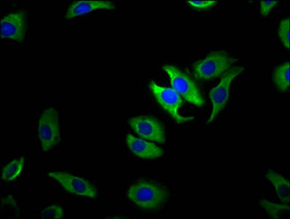 TRPM1 Antibody (PACO60188)