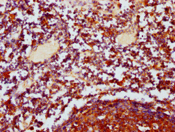 POLRMT Antibody (PACO60785)