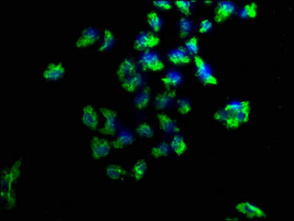 PRKD1 Antibody (PACO62751)