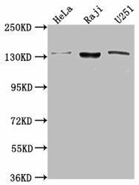 LARS Antibody (PACO62811)