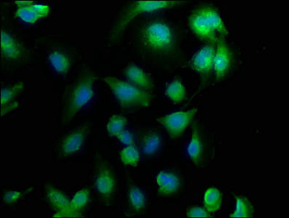 CHML Antibody (PACO63635)