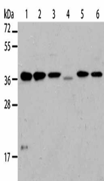 NFKBIA Antibody (PACO13936)