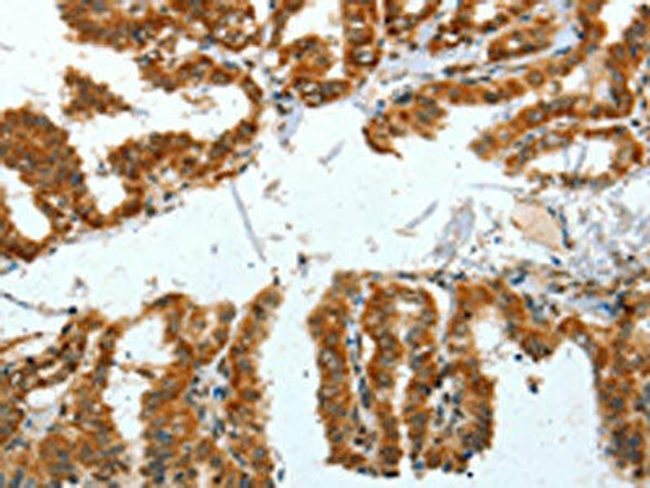 BNIP1 Antibody (PACO13963)