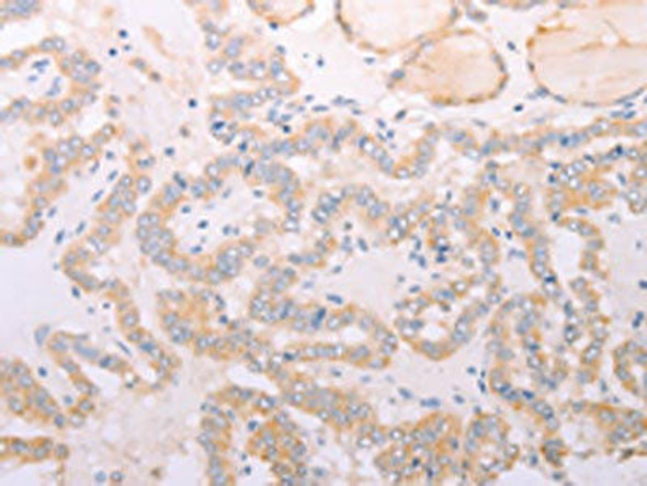 ADIPOR1 Antibody (PACO14008)