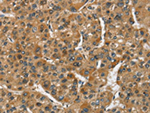 ATF4 Antibody (PACO14118)