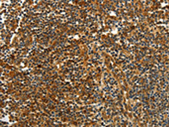 CNNM3 Antibody (PACO14315)