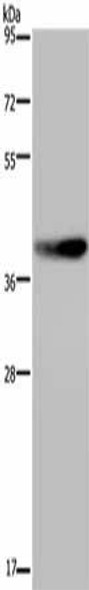 DUSP4 Antibody (PACO14398)