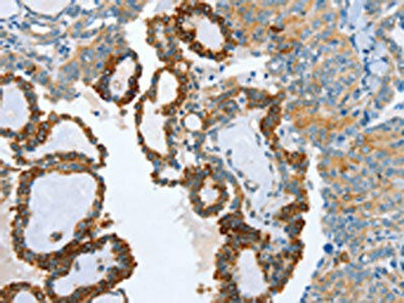 AIP Antibody (PACO19130)