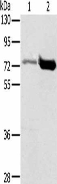 PIAS1 Antibody (PACO19170)