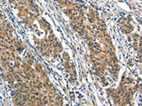 BNIP3L Antibody (PACO19309)