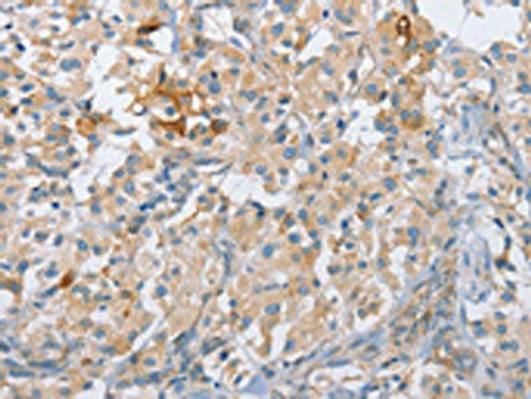 CENPE Antibody (PACO19461)