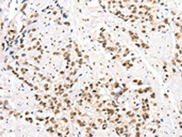 CTBP2 Antibody (PACO19526)