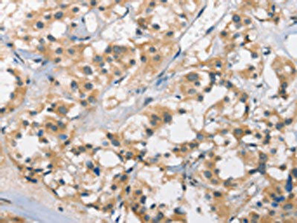 DGAT1 Antibody (PACO19569)