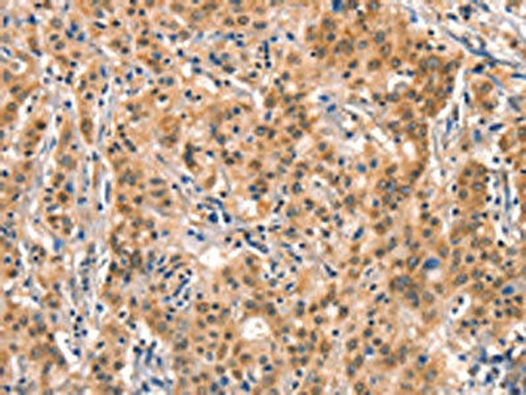 AIMP1 Antibody (PACO19597)