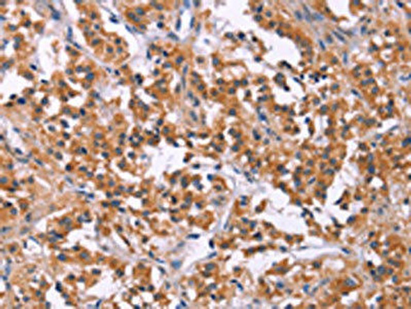 MSMO1 Antibody (PACO19616)