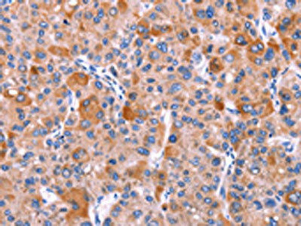 GCG Antibody (PACO19633)