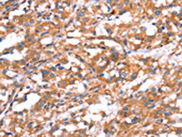 GABBR1 Antibody (PACO19685)
