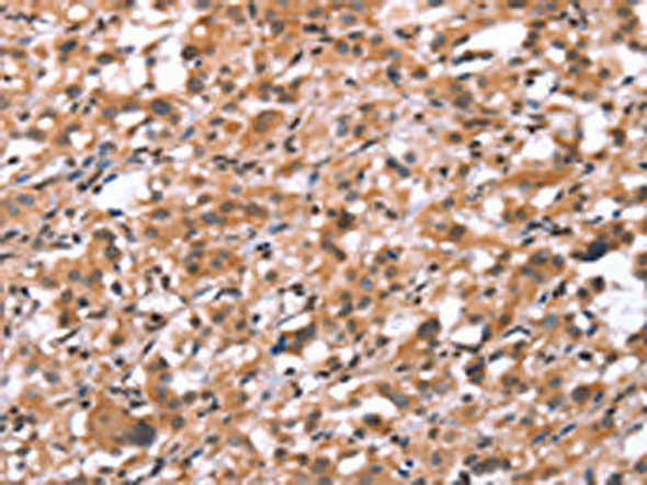 GNAT3 Antibody (PACO19723)