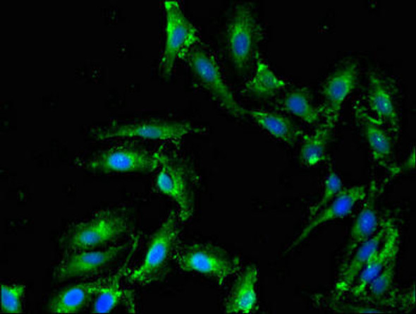 PLD1 Antibody (PACO50494)