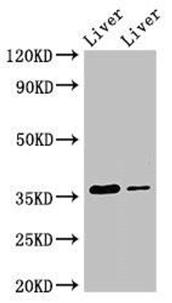 GRHPR Antibody (PACO51594)