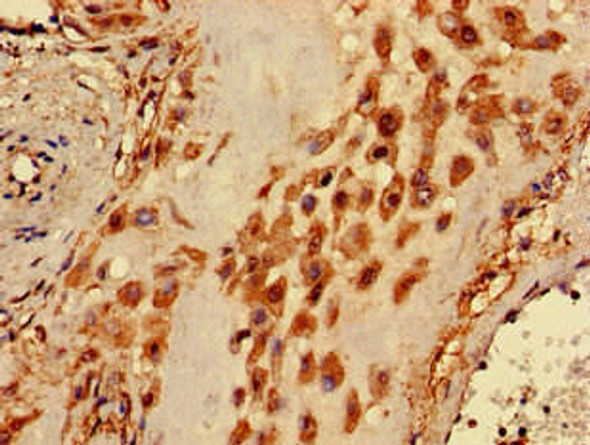 PIGA Antibody (PACO53030)