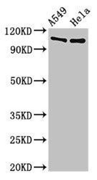 EML4 Antibody (PACO53162)