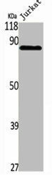 PFKP Antibody (PACO06744)