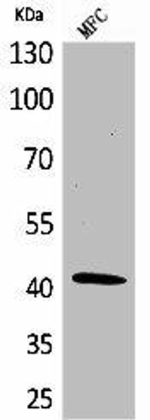 ACTA1 Antibody (PACO06863)