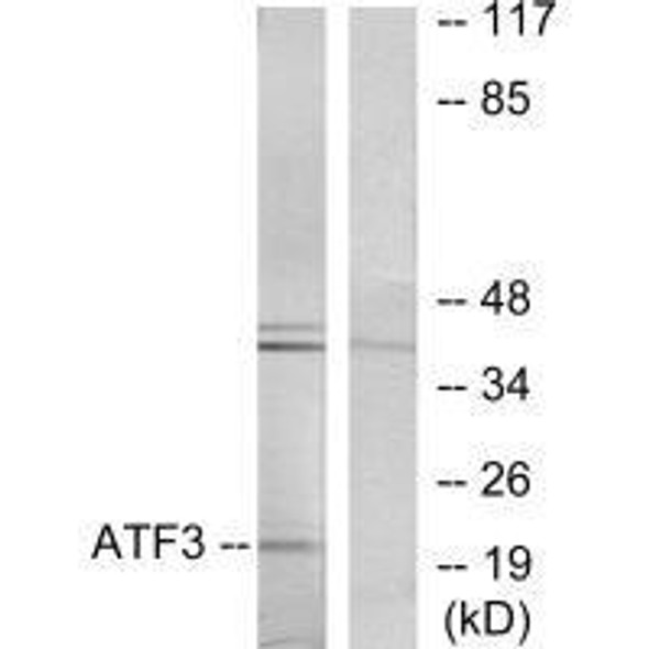 ATF3 Antibody (PACO21745)
